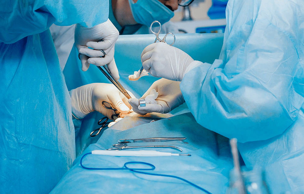 Método cirúrxico de ampliación do pene